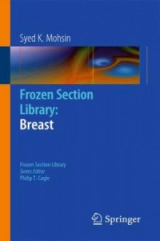 Book Breast Syed K. Mohsin