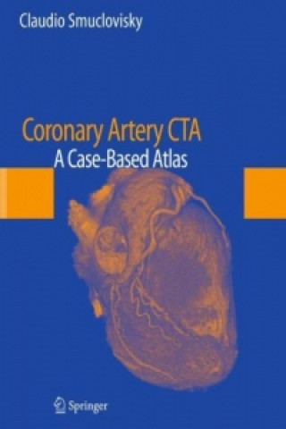 Knjiga Coronary Artery CTA Claudio Smuclovisky