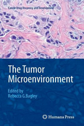 Carte Tumor Microenvironment Rebecca G. Bagley