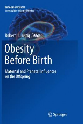 Kniha Obesity Before Birth Robert H Lustig