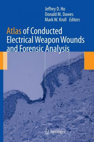 Carte Atlas of Conducted Electrical Weapon Wounds and Forensic Analysis Jeffrey D. Ho