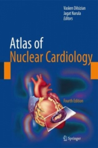 Książka Atlas of Nuclear Cardiology Vasken Dilsizian