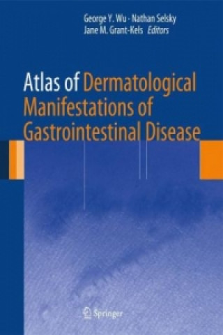 Könyv Atlas of Dermatological Manifestations of Gastrointestinal Disease George Y. Wu