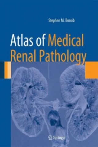 Carte Atlas of Medical Renal Pathology Stephen M. Bonsib