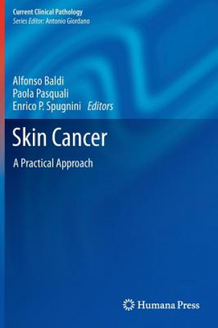 Kniha Skin Cancer Alfonso Baldi