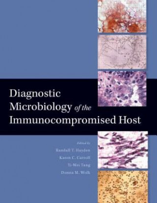 Книга Diagnostic Microbiology of the Immunocompromised Host Randall T. Hayden