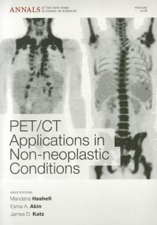 Kniha PET CT Applications in Non-Neoplastic Conditions, Volume 1228 Mandana Hashefi