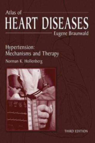 Kniha Atlas of Heart Diseases Eugene Braunwald