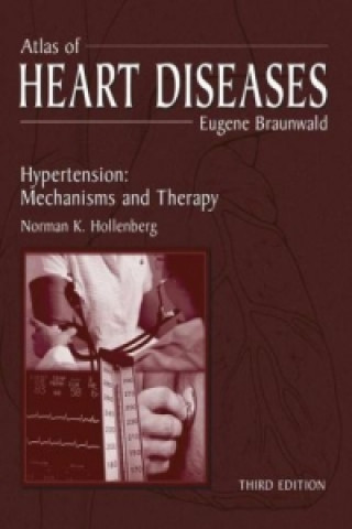 Книга Atlas of Heart Diseases Eugene Braunwald