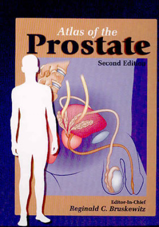 Kniha Atlas of the Prostate Reginald Bruskewitz