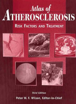 Książka Atlas of Atherosclerosis Peter W.F. Wilson