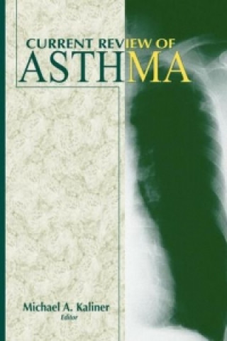 Könyv Current Review of Asthma Michael A. Kaliner