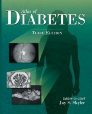 Libro Atlas of Diabetes Jay S. Skyler