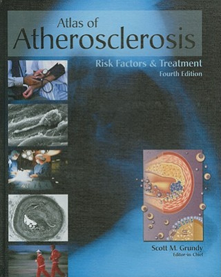 Buch Atlas of Atherosclerosis and Metabolic Syndrome Scott M. Grundy