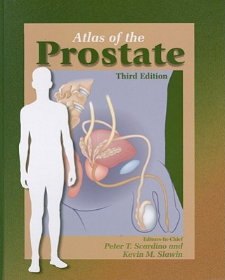 Kniha Atlas of the Prostate Peter T. Scardino