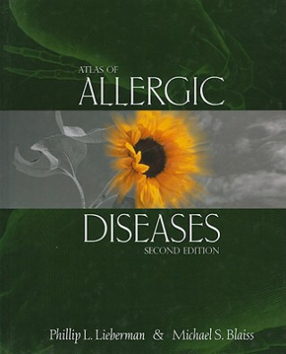 Livre Atlas of Allergic Diseases Phillip L. Lieberman