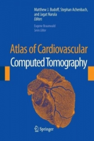 Carte Atlas of Cardiovascular Computed Tomography Matthew J. Budoff