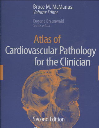 Kniha Atlas of Cardiovascular Pathology for the Clinician Bruce M. McManus