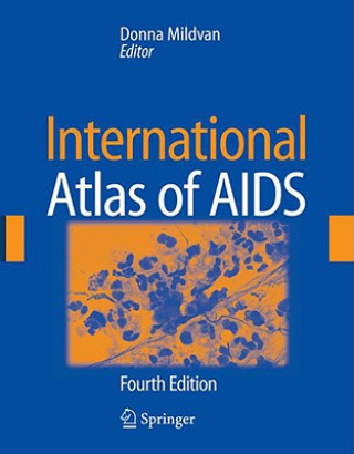 Carte International Atlas of AIDS Donna Mildvan
