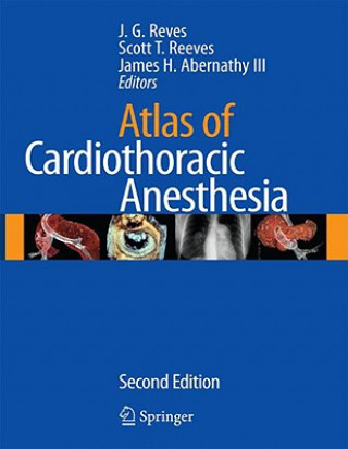 Kniha Atlas of Cardiothoracic Anesthesia Patricia Revest