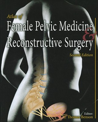 Kniha Atlas of Female Pelvic Medicine and Reconstructive Surgery J. Thomas Benson