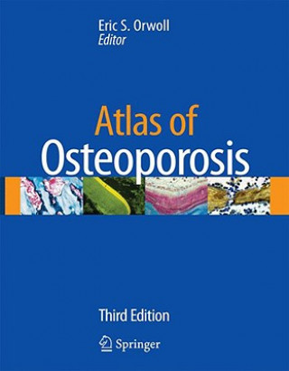 Knjiga Atlas of Osteoporosis Eric Orwoll