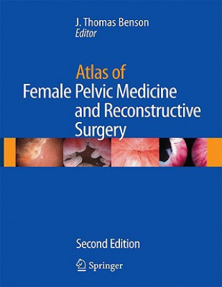 Libro Atlas of Female Pelvic Medicine and Reconstructive Surgery J. Thomas Benson