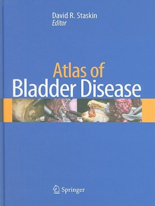 Kniha Atlas of Bladder Disease David Staskin