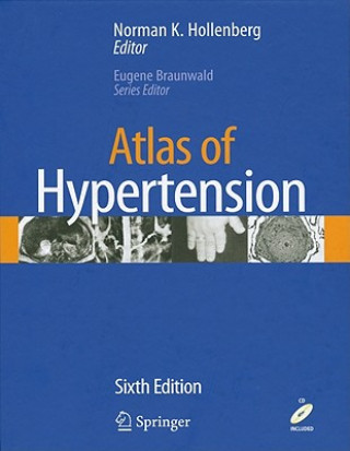 Книга Atlas of Hypertension Norman K. Hollenberg