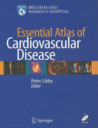 Knjiga Essential Atlas of Cardiovascular Disease Peter Libby