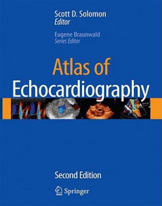 Kniha Atlas of Echocardiography Scott D. Solomon