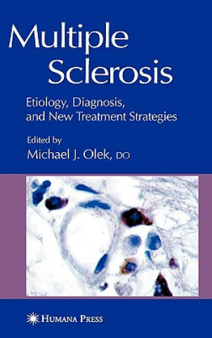 Könyv Multiple Sclerosis lek