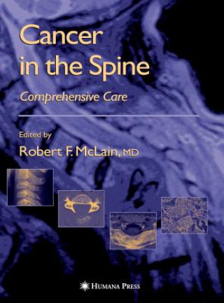 Kniha Cancer in the Spine McLain