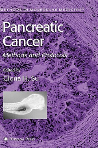 Książka Pancreatic Cancer Gloria H. Su