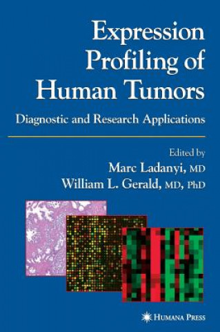 Kniha Expression Profiling of Human Tumors Marc Ladanyi