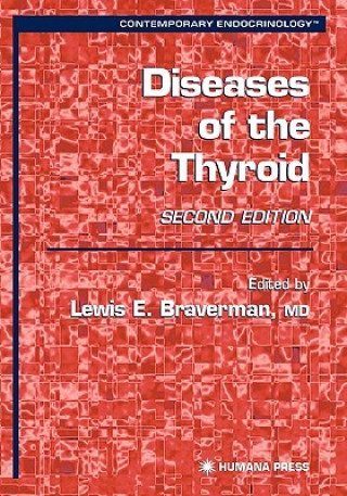 Carte Diseases of the Thyroid Lewis E. Braverman