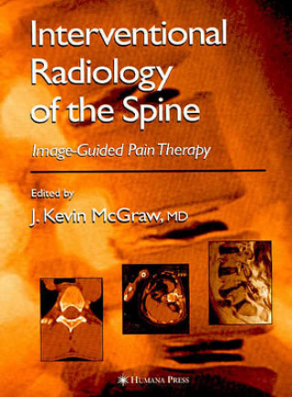 Kniha Interventional Radiology of the Spine cGraw