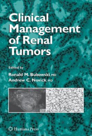Книга Clinical Management of Renal Tumors Ronald M. Bukowski