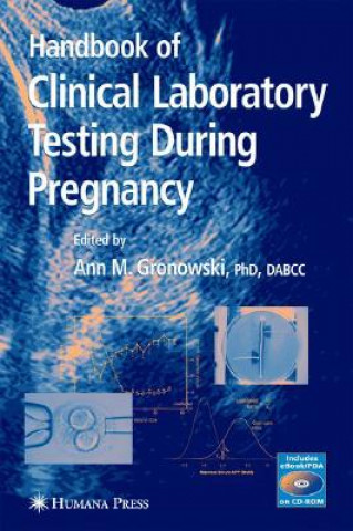 Kniha Handbook of Clinical Laboratory Testing During Pregnancy Ann M. Gronowski