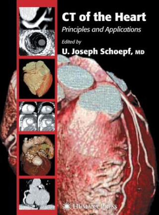 Книга CT of the Heart choepf