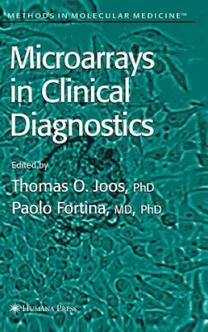 Kniha Microarrays in Clinical Diagnostics Thomas O. Joos