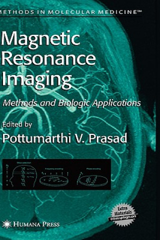 Kniha Magnetic Resonance Imaging rasad