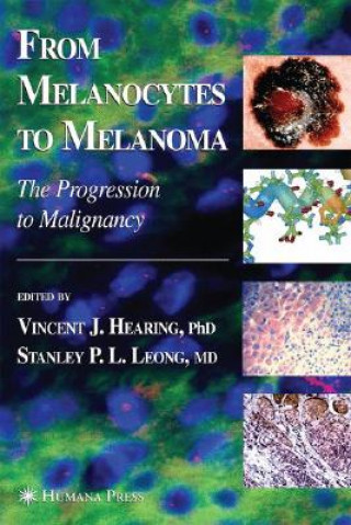 Книга From Melanocytes to Malignant Melanoma, w. CD-ROM earing