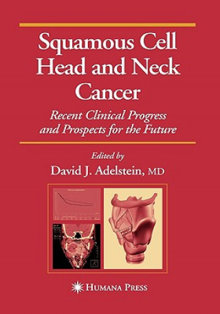 Könyv Squamous Cell Head and Neck Cancer David J. Adelstein