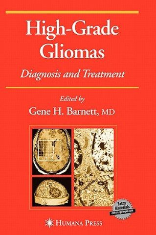 Könyv High-Grade Gliomas Gene H. Barnett