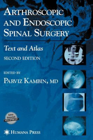 Kniha Arthroscopic and Endoscopic Spinal Surgery Parviz Kambin