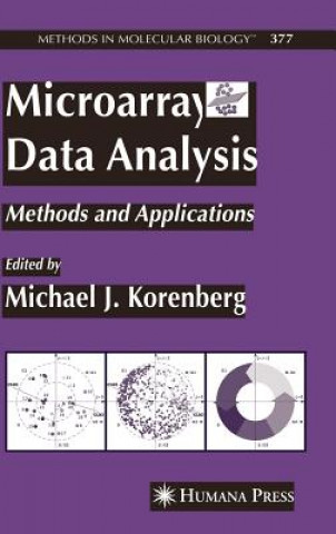 Carte Microarray Data Analysis Michael J. Korenberg