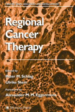 Knjiga Regional Cancer Therapy Peter M. Schlag