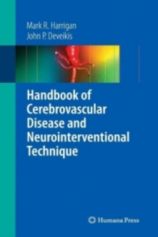 Kniha Handbook of Cerebrovascular Disease and Neurointerventional Technique Mark R. Harrigan