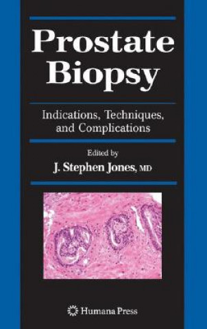 Libro Prostate Biopsy J. Stephen Jones